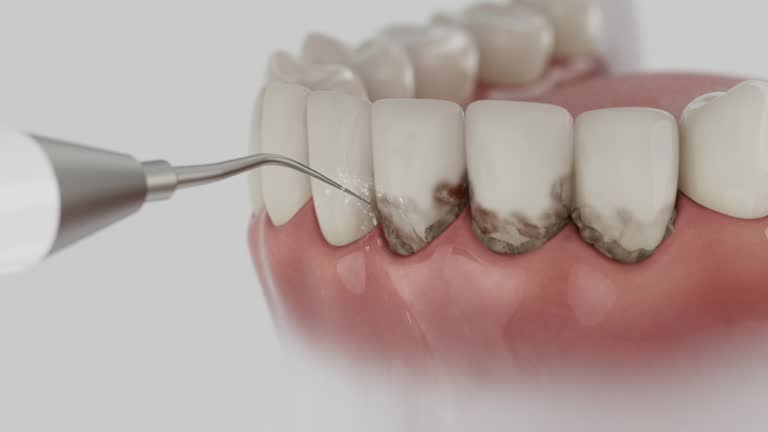 Reliable Dental contractor in Zeigler, IL by Dentist Open Now